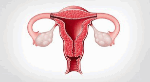 子宫内膜异位症治疗：子宫内膜异位症的3种治疗方法！